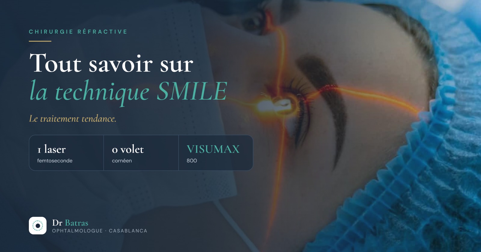 Tout savoir sur la technique SMILE de chirurgie réfractive